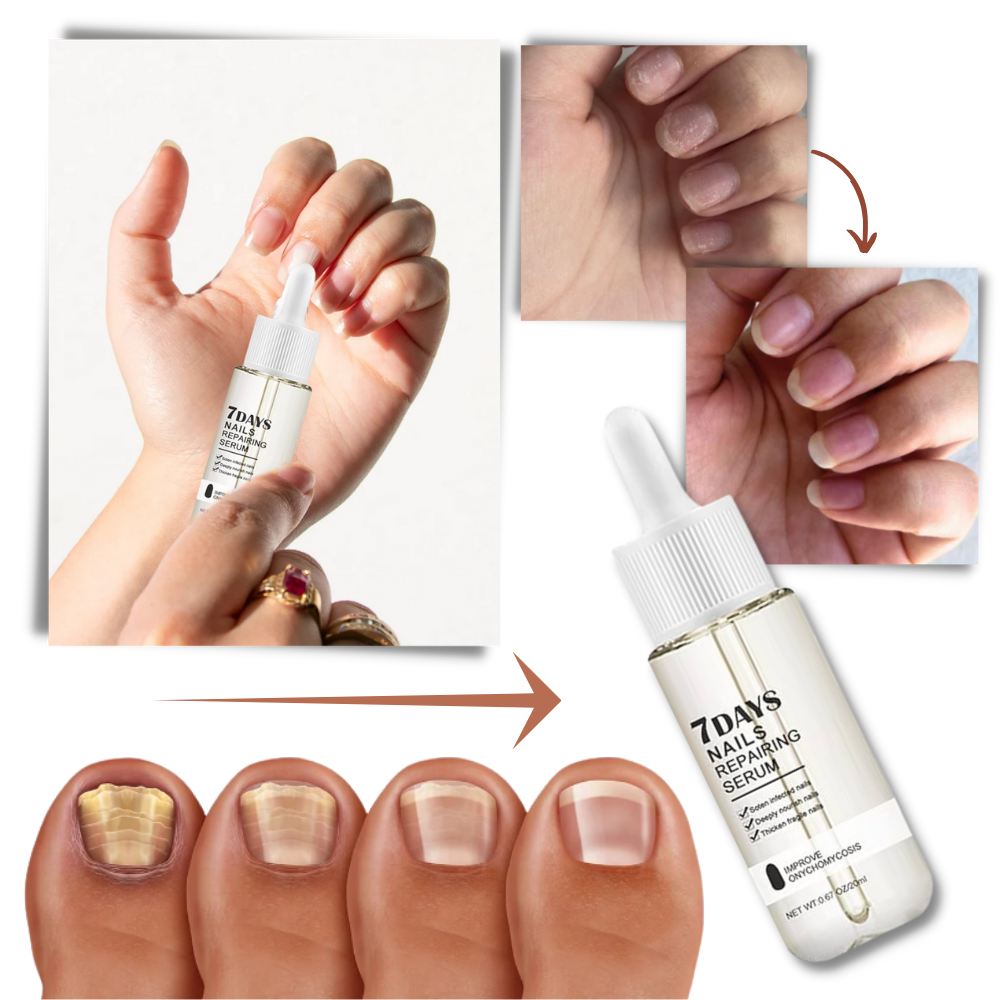 Belro 7 Days Nail Repair Essence in a small bottle, designed to strengthen and repair damaged nails naturally.