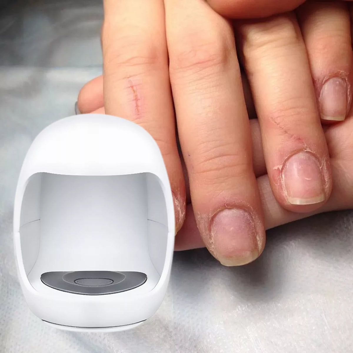 Belro fungal laser toe treatment clip-on device for health and beauty, designed to treat fungal infections on toes.