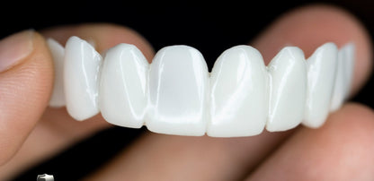 Flexible BowLift Sandsberg20250613 dental prosthesis with natural look and comfortable fit, shown in a close-up view.