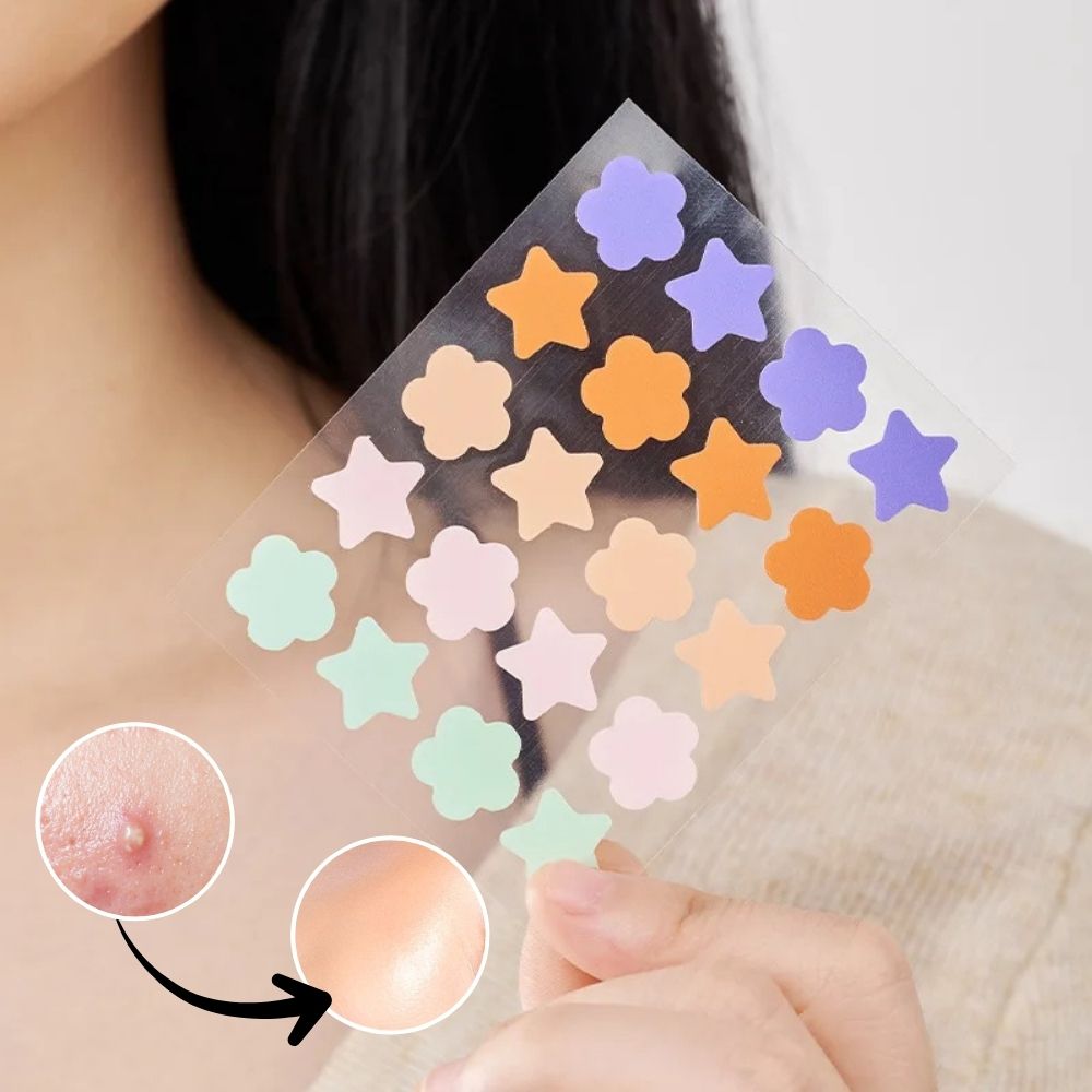 Belro hydrocolloid pimple acne patch sticker on skin, designed for men to cover and treat acne effectively.