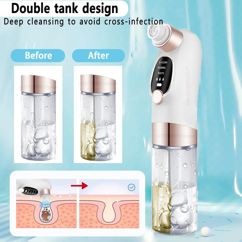 Belro blackhead remover tool for skin care, featuring a precision stainless steel tip for extracting blackheads and impurities.