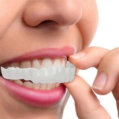 Belro Smile Veneer set with upper and lower veneers, designed for oral care and teeth whitening, displayed on a clean white background.