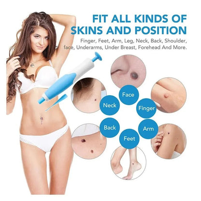 Belro Skin Tag Removal Kit for men, featuring tools and solutions for safe at-home skin tag removal.