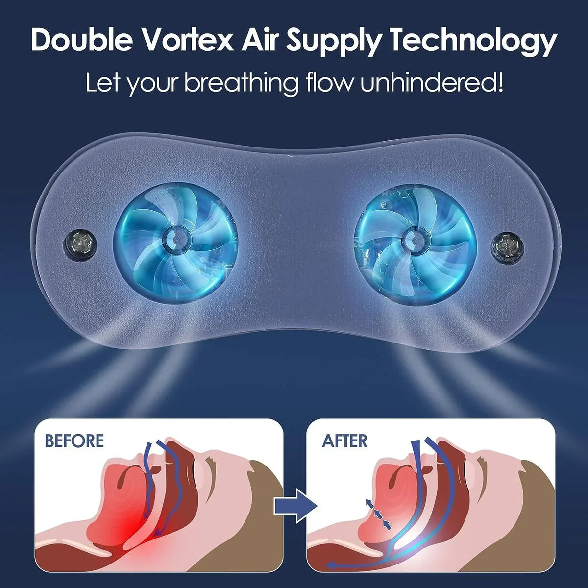 NordisHome portable Micro CPAP sleep apnea machine with travel case, compact design, and anti-snoring features for better sleep.