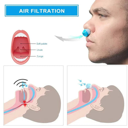 Belro Airing Micro-CPAP device for anti-snoring relief, compact sleep aid machine with nasal mask and tubing.