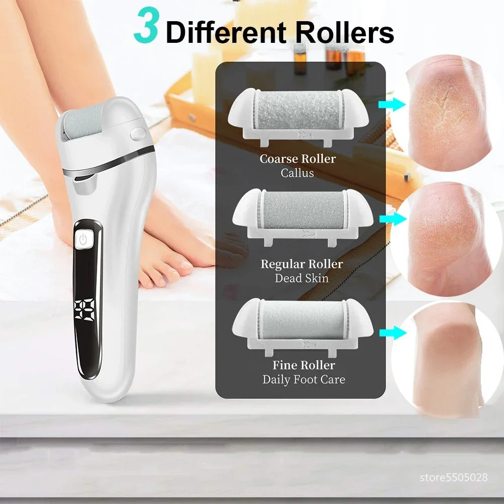 Belro electric callus remover for smooth, healthy skin; handheld device with roller head for foot and skin exfoliation.