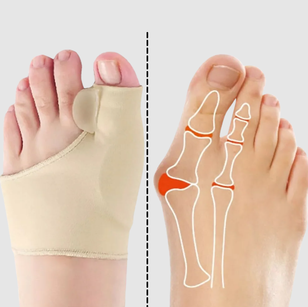 Belro gel bunion corrector pad designed to cushion and support bunion relief, shown on a foot in a health and beauty setting.