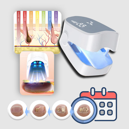 Belro painless nail fungus laser device used for health and beauty nail treatment, shown in the image.