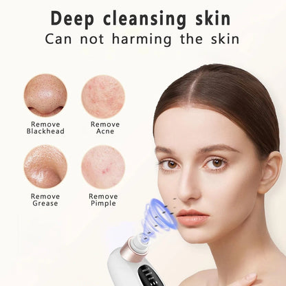 Belro Blackhead Remover Tool for skin care, featuring a stainless steel tip for extracting blackheads and blemishes.
