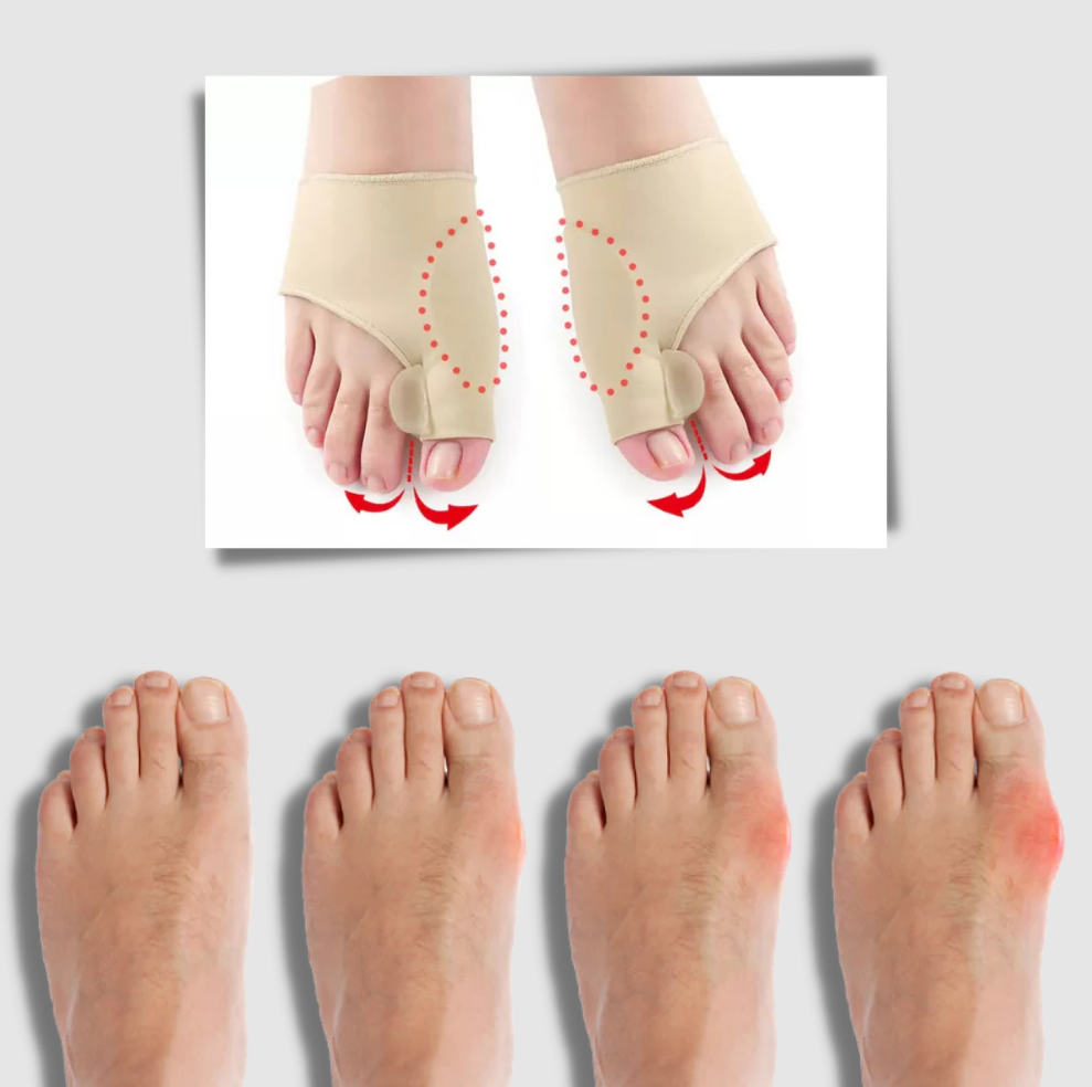 Belro gel bunion corrector worn on toes, soft silicone pad designed to realign and comfort bunion-affected toes.