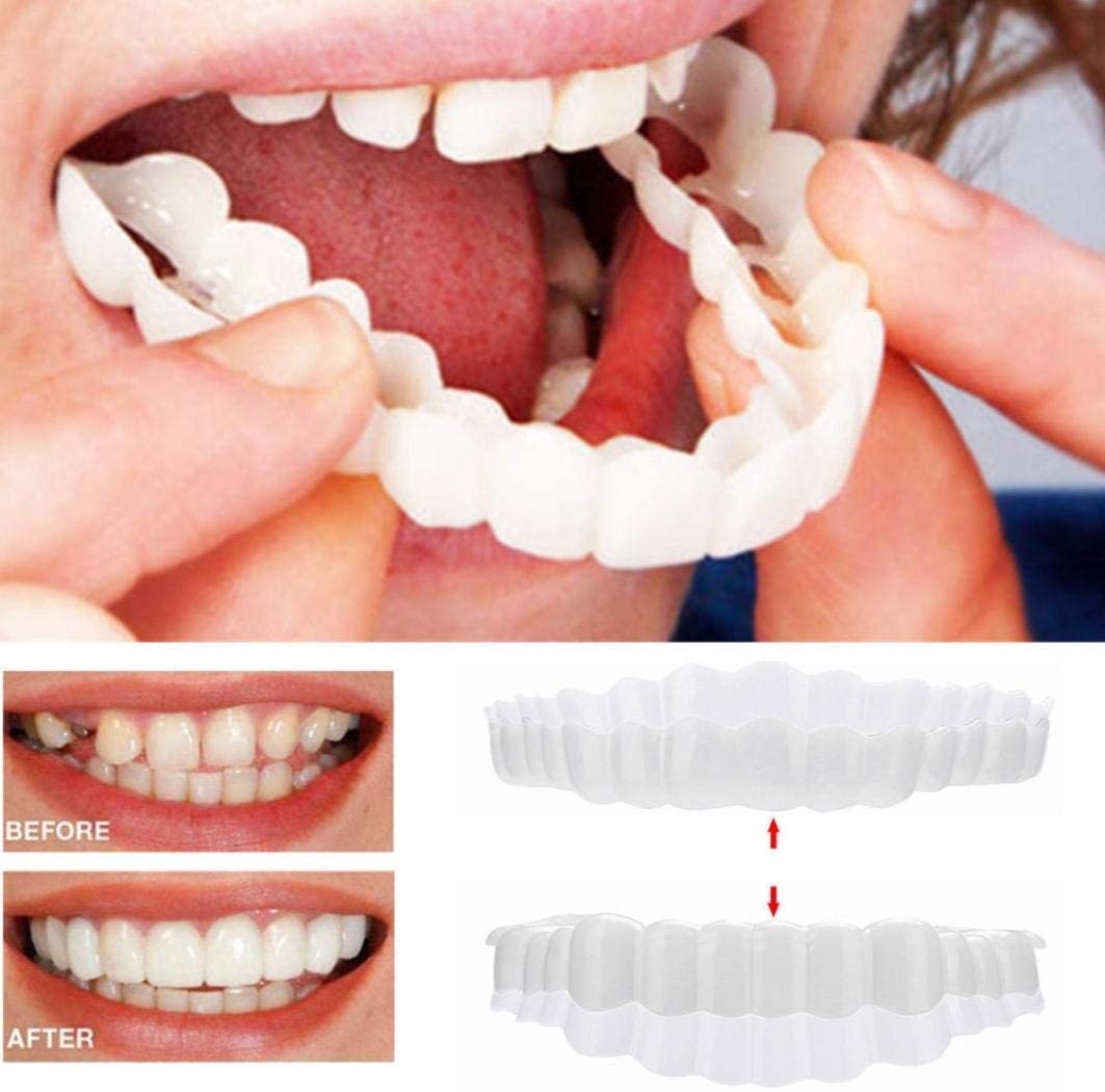 Belro Smile Veneer set with upper and lower veneers for oral beauty and whitening, displayed on a clean, white background.