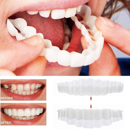 Belro Smile Veneer set with upper and lower veneers for oral beauty and whitening, displayed on a clean, white background.