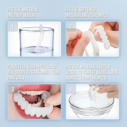 Belro Smile Veneer set with upper and lower veneers, showcasing clear, natural-looking dental covers on a model's teeth.