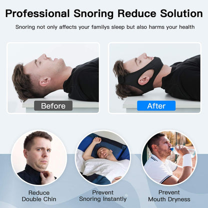 Belro anti snoring chin strap for sleep apnea, adjustable sleep aid device to reduce snoring and improve sleep quality.