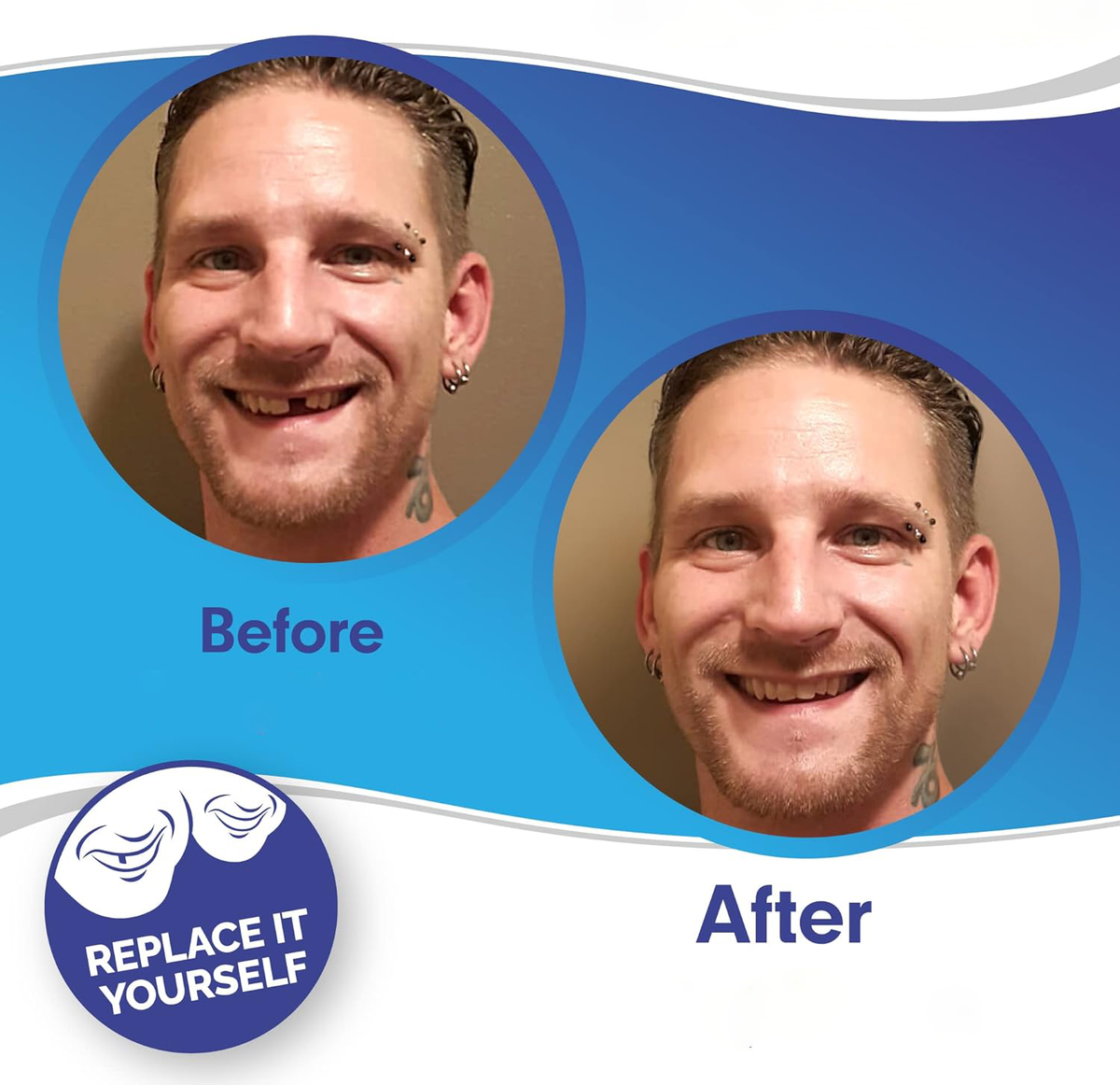 Belro Smile Veneer set with upper and lower veneers, designed for oral care and teeth whitening, shown on a white background.