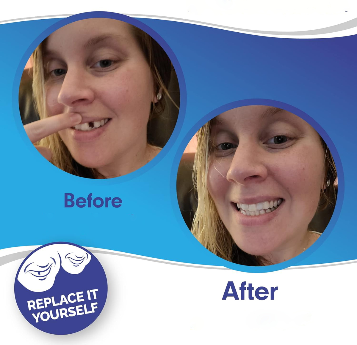 Belro Smile Veneer set for upper and lower teeth, designed for oral care and teeth whitening, shown in the product image.