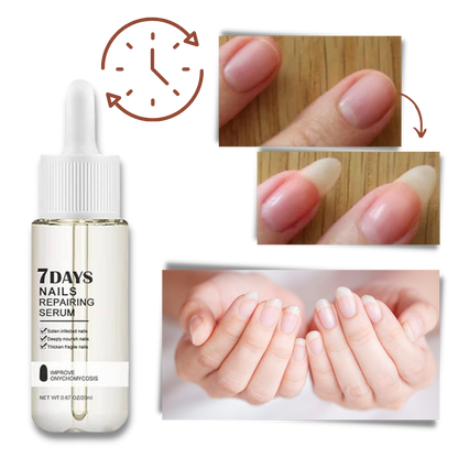 Belro 7 Days Nail Repair Essence bottle shown with applicator brush, designed for strengthening and nourishing nails.