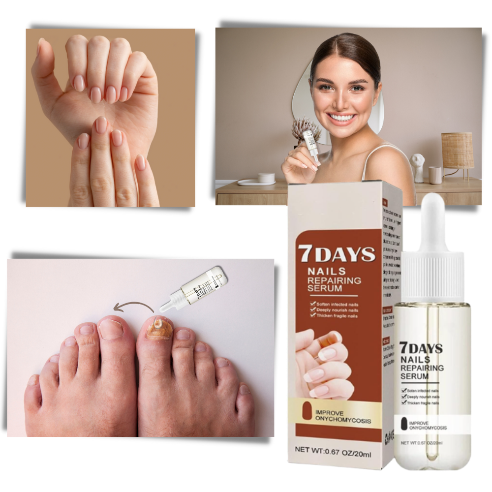 Belro 7 Days Nail Repair Essence bottle with dropper for strengthening and nourishing nails in a health and beauty nail care line
