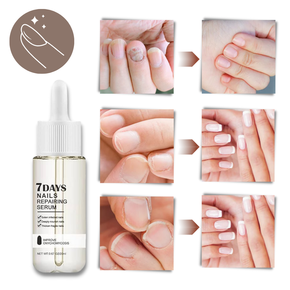 Belro 7 Days Nail Repair Essence bottle with dropper, designed to strengthen and repair weak, damaged nails.
