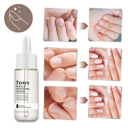Belro 7 Days Nail Repair Essence bottle with dropper, designed to strengthen and repair weak, damaged nails.