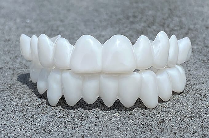 Flexible BowLift Sandsberg20250613 dental prosthesis with natural look and comfortable fit shown in the image.