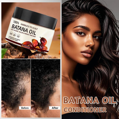 Belro Natural Hair Growth Oil Serum set with dropper bottles, promoting healthy hair and scalp care in a beauty hair care collection.