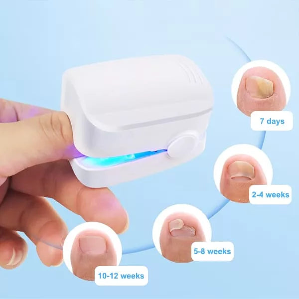 Belro Nail Fungus Cleaning Laser Device used on toenails, showcasing the compact health and beauty treatment tool for fungal infections.