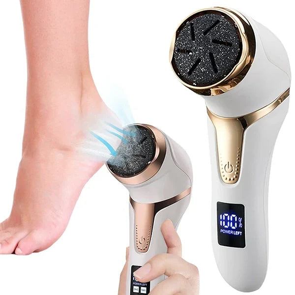 Belro vacuum callus remover with ergonomic handle and soft roller for gentle, effective foot skin exfoliation.