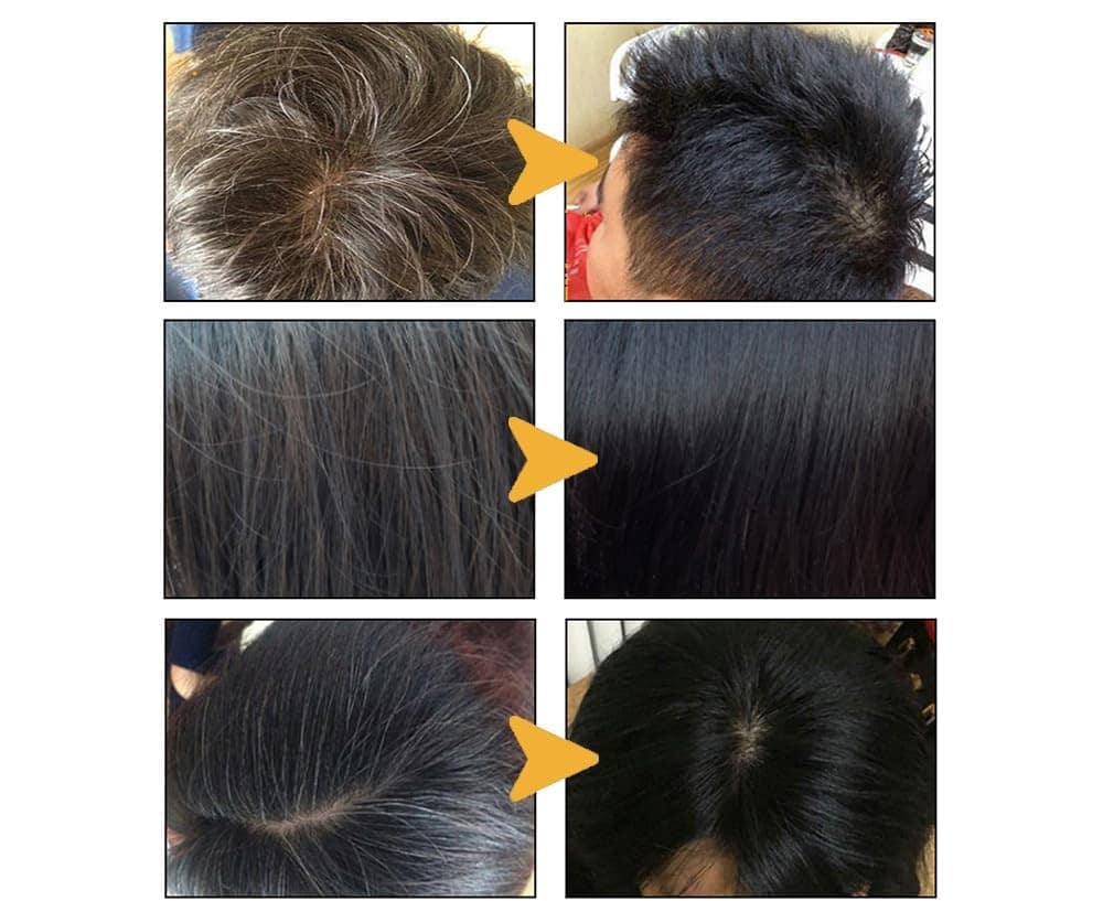 Belro anti-gray hair shampoo treatment bottle shown, designed to reduce gray hair and enhance hair color health.