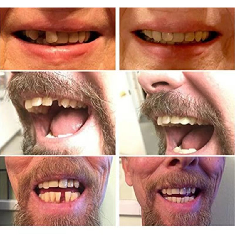 Belro high-quality false teeth with realistic appearance, designed for oral care and dental aesthetics.