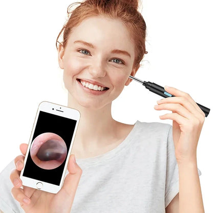 Belro intelligent visual earwax removal device with built-in camera and light, designed for safe ear cleaning and hygiene.