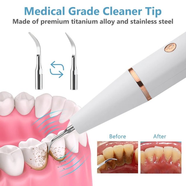 Belro ultrasonic scaling wand with LED light, USB charging port, and ergonomic design for safe at-home dental cleaning.