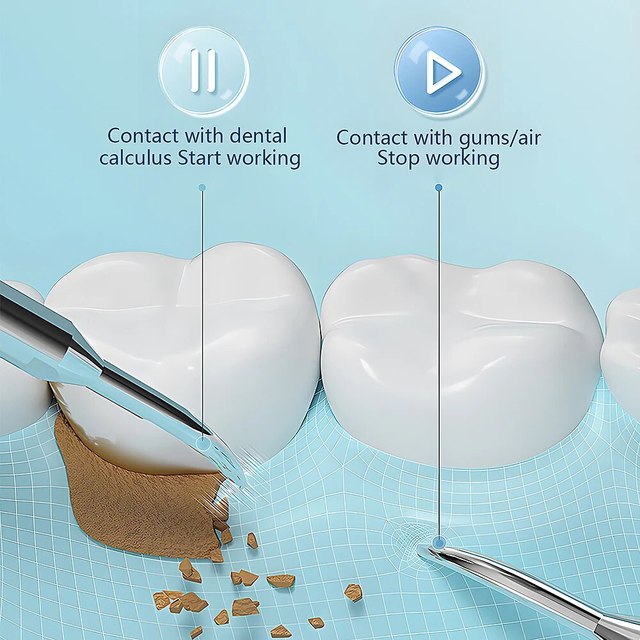 Belro ultrasonic scaling wand for tooth cleaning with LED light and USB quick-charge, an efficient dental device for home use