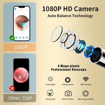 Belro ear cleaning picker with built-in camera for safe, detailed ear inspection and hygiene maintenance.