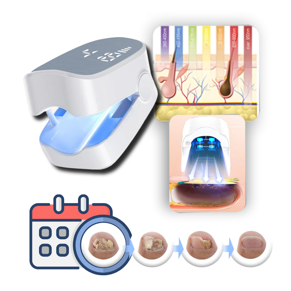 Belro painless laser treatment device for nail fungus, showing the sleek handheld tool used in health and beauty procedures.