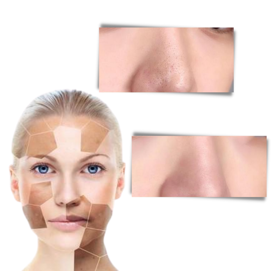Belro green tea face mask for cleansing and anti-blackhead treatment, showing a jar with green tea-infused skincare product.