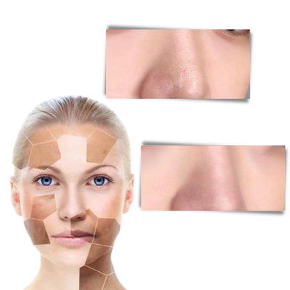 Belro green tea face mask for cleansing and anti-blackhead treatment, showing a jar with green tea-infused skincare product.