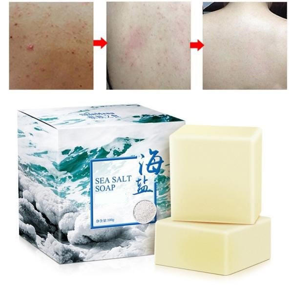 Belro sea salt soap for acne treatment, featuring a bar of exfoliating soap with sea salt for men's skincare.