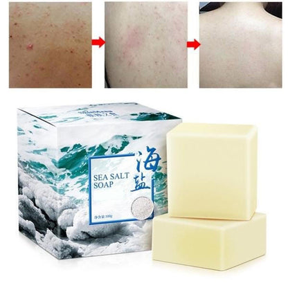 Belro sea salt soap for acne treatment, featuring a bar of exfoliating soap with sea salt for men's skincare.