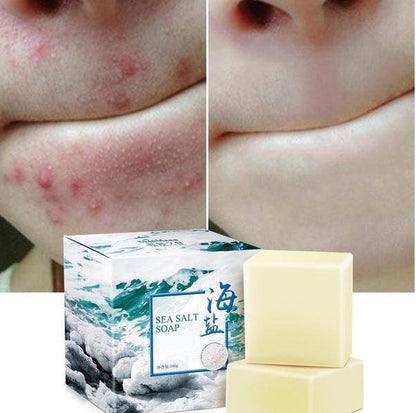 Belro Sea Salt Acne Treatment Soap for men, showing the textured soap bar with sea salt crystals and packaging.