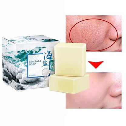 Belro Sea Salt Soap for acne treatment, featuring natural sea salt and cleansing ingredients, designed for men's skincare.