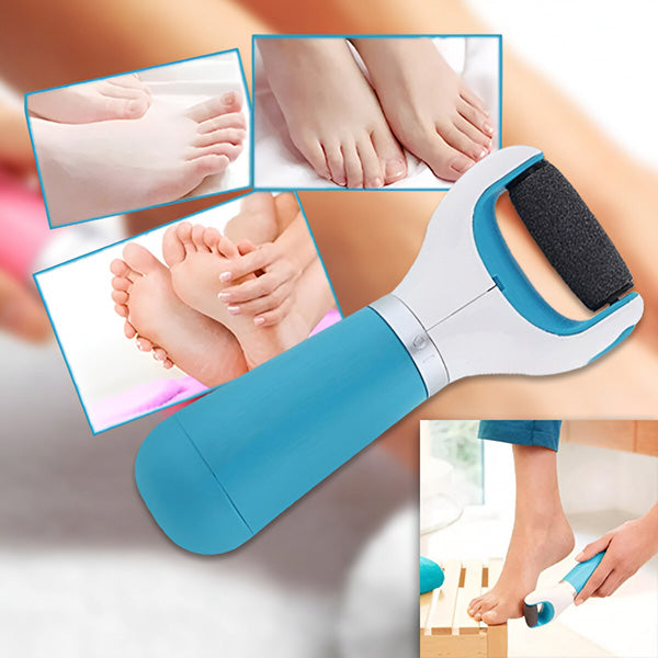 Belro electric callus remover for smooth feet, featuring a compact design and exfoliating roller for healthy, soft skin.