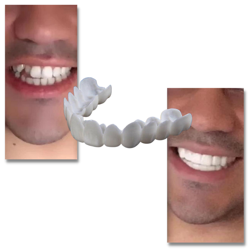 Belro dental aligners for a perfect smile, clear and comfortable orthodontic teeth straightening solution.