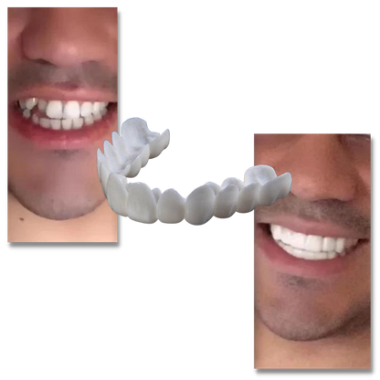 Belro dental aligners for a perfect smile, clear and comfortable orthodontic teeth straightening solution.
