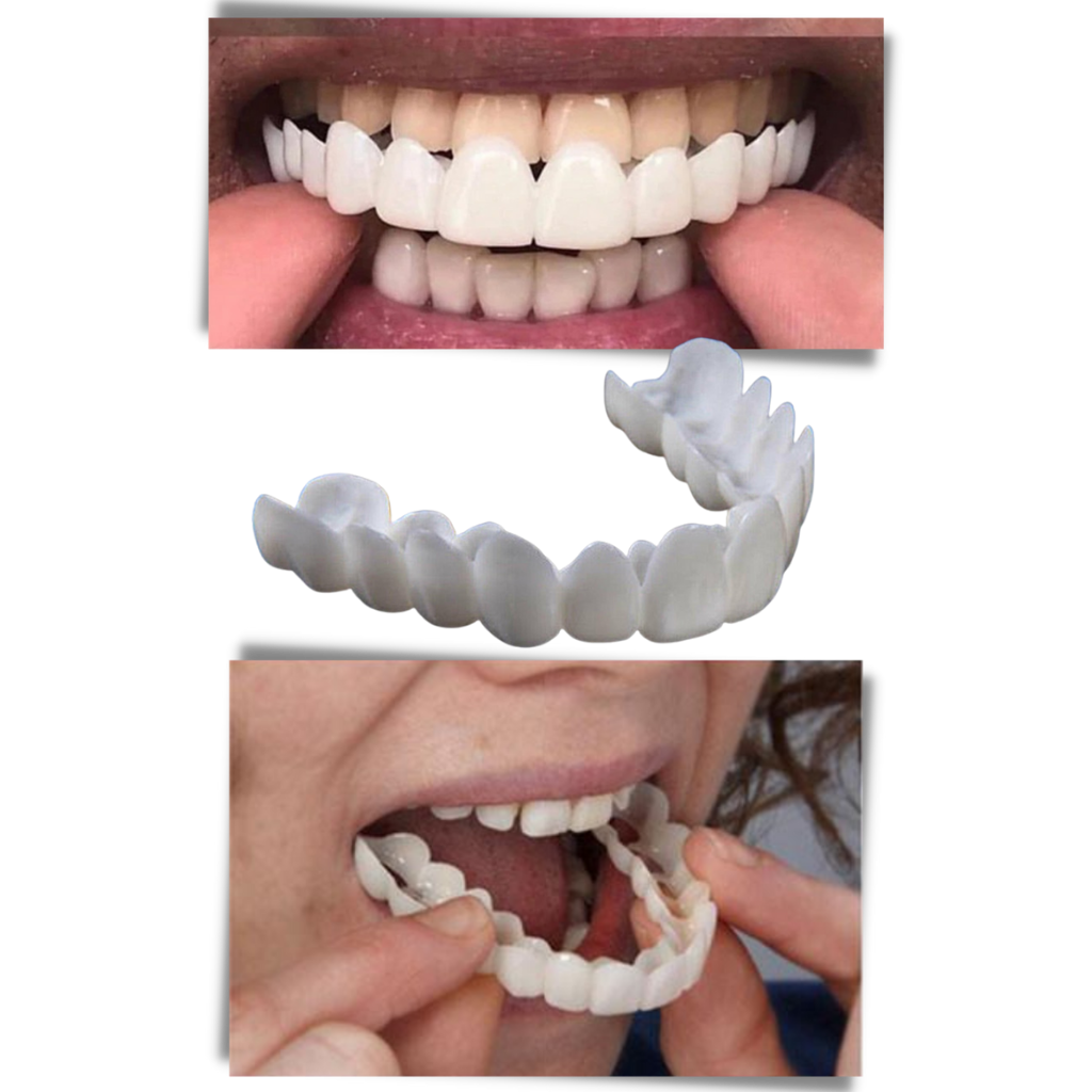 Belro dental aligners for perfect smile, comfortable clear orthodontic aligners for effective oral care and teeth straightening.