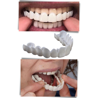 Belro dental aligners for perfect smile, comfortable clear orthodontic aligners for effective oral care and teeth straightening.