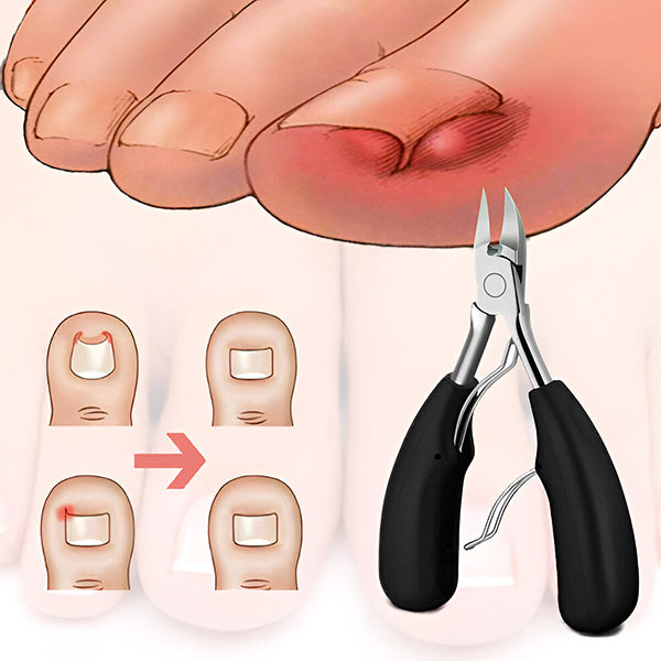 Belro premium nail care kit with assorted nail polish, tools, and accessories for professional-looking manicures and nail maintenance.