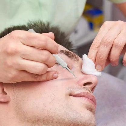 Belro blackhead pliers from the anti blackhead kit, featuring stainless steel tips and ergonomic handles for skin care extraction.