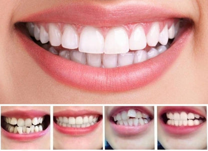 Belro Invisible Dental Realignment Tray for sleep support, shown in clear plastic with soft, molded design for teeth alignment.