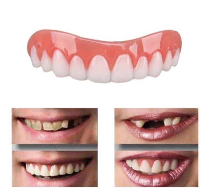 Belro artificial teeth cover for a perfect smile, showcasing a realistic dental prosthetic in a close-up view.